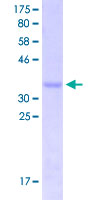 12.5% SDS-PAGE Stained with Coomassie Blue